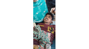 চাঁপাইনবাবগঞ্জে মামীর সাথে পরকীয়ার জেরে যুবকের কব্জি কেটে নিয়েছে মেয়ের পরিবার