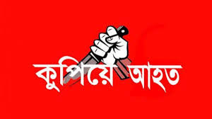 চাঁপাইনবাবগঞ্জে পুলিশ স্বামীকে কুপিয়ে আহত করেছে স্ত্রী 